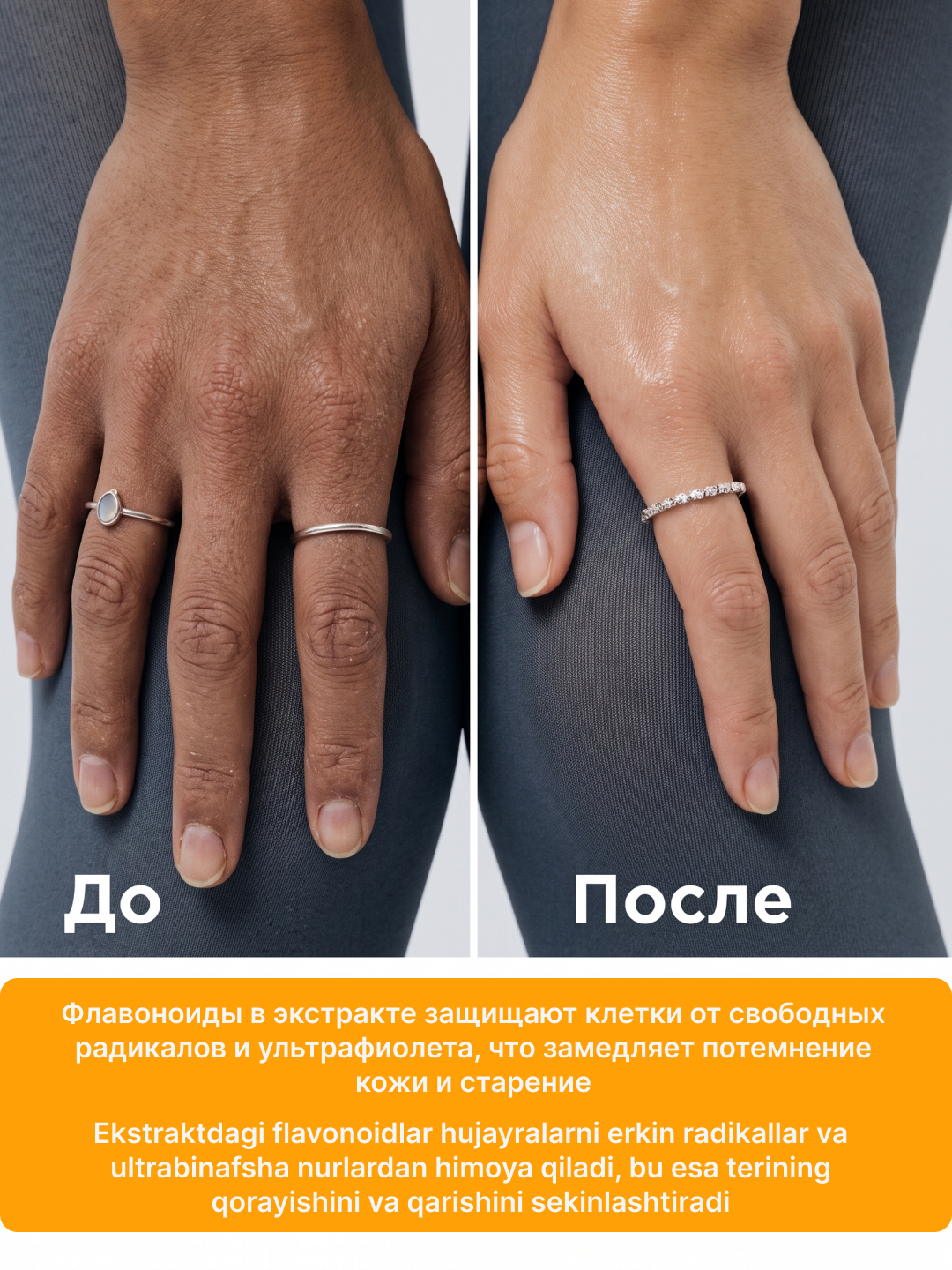 Отбеливающий крем для лица и тела, против веснушек, постакне и пигментации, витамин С