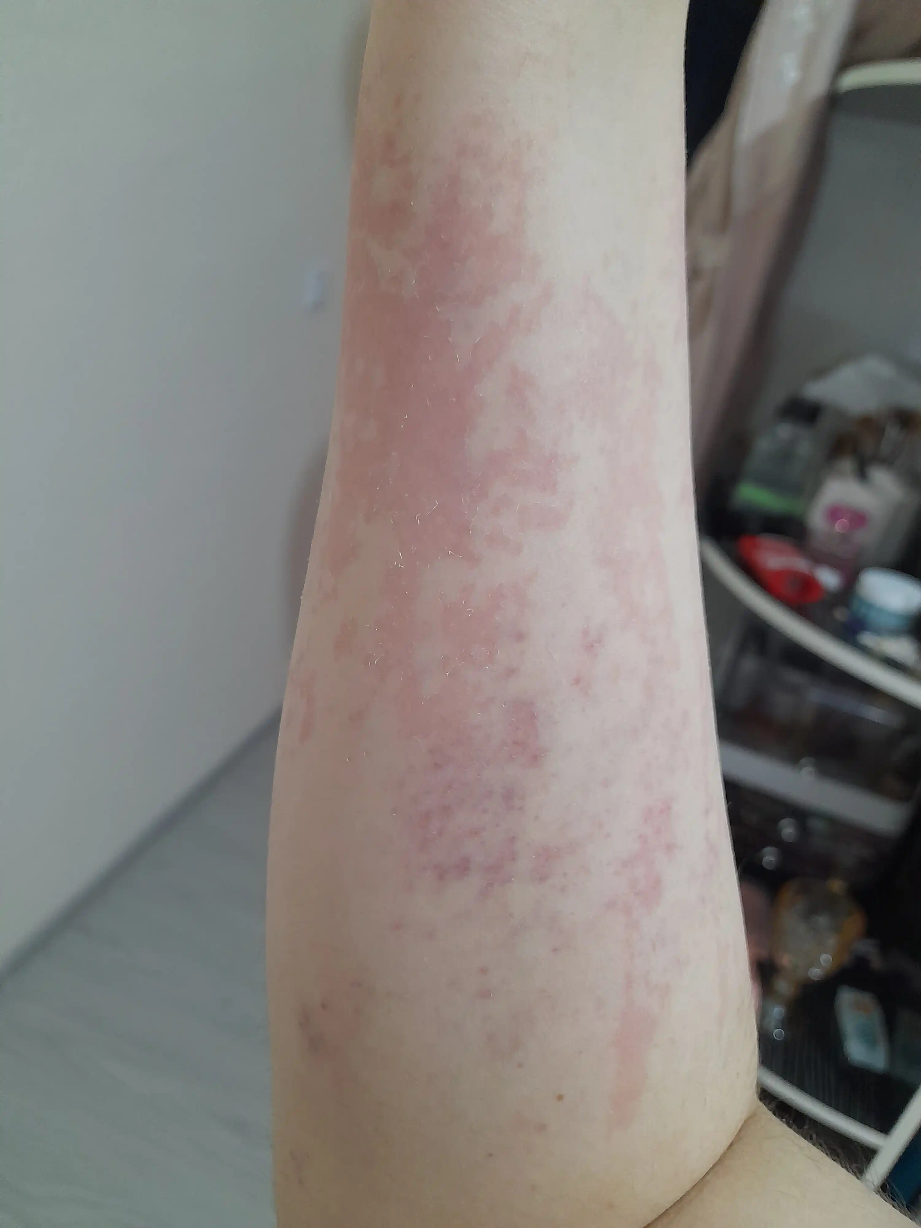 Italwax «Qulupnay» kartrijdagi depilyatsiya mumi, 100 ml