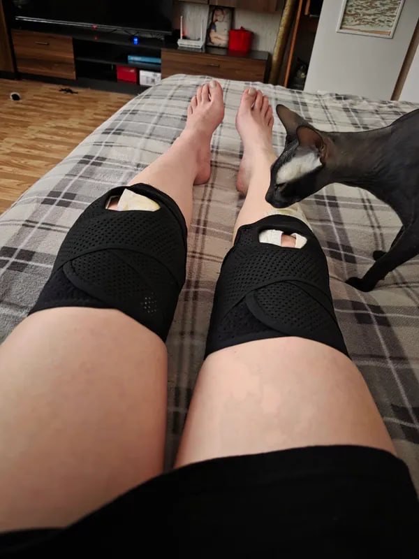 Ortopedik tizza bandaji, yon prujinali fiksatsiya, sport va tiklanish uchun, 1 dona