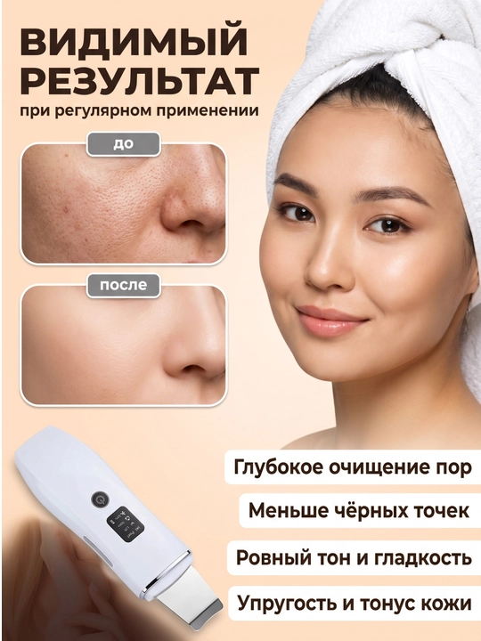 Ультразвуковой скраббер для лица OVLEN 4 режима