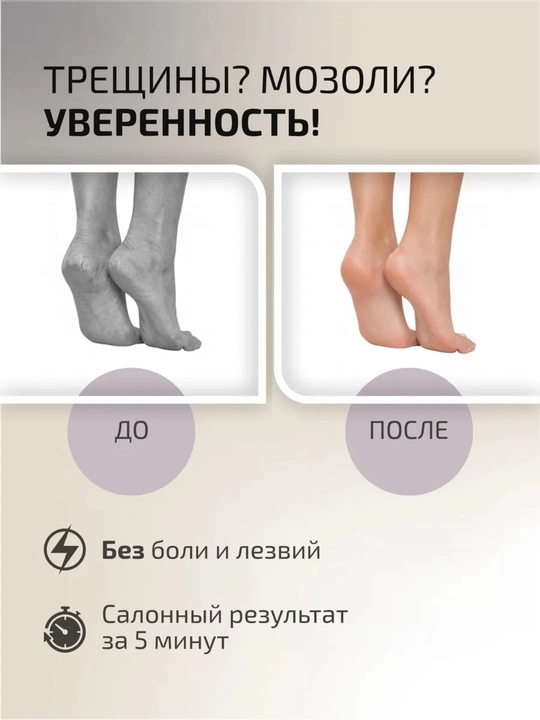 Смарт аппарат для педикюра аккумуляторный, беспроводной смарт диск с насадками, 30 шт