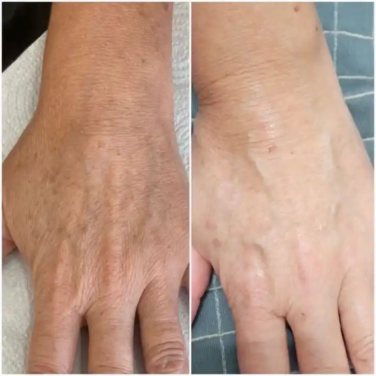 Yuz terisini namlantiradigan yoshartiradigan oqartiradigan Collagen kremi