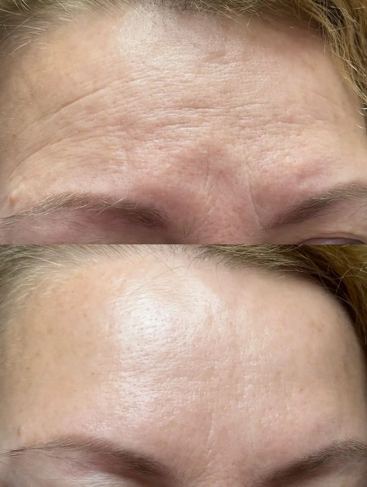 Yuz terisini namlantiradigan yoshartiradigan oqartiradigan Collagen kremi