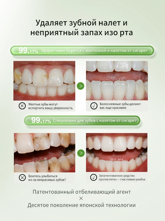 LYDIMOON probiotikli oqartiruvchi tish pastasi, yasemin, nafasni yangilaydi, 120 g