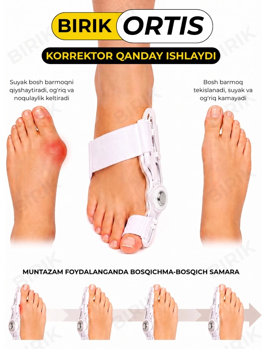 BIRIK ORTIS - bosh barmoq ortezi, sharnirli fiksator, 34-45, 1 dona