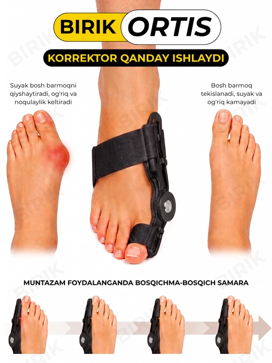 BIRIK ORTIS - bosh barmoq ortezi, sharnirli fiksator, 34-45, 1 dona