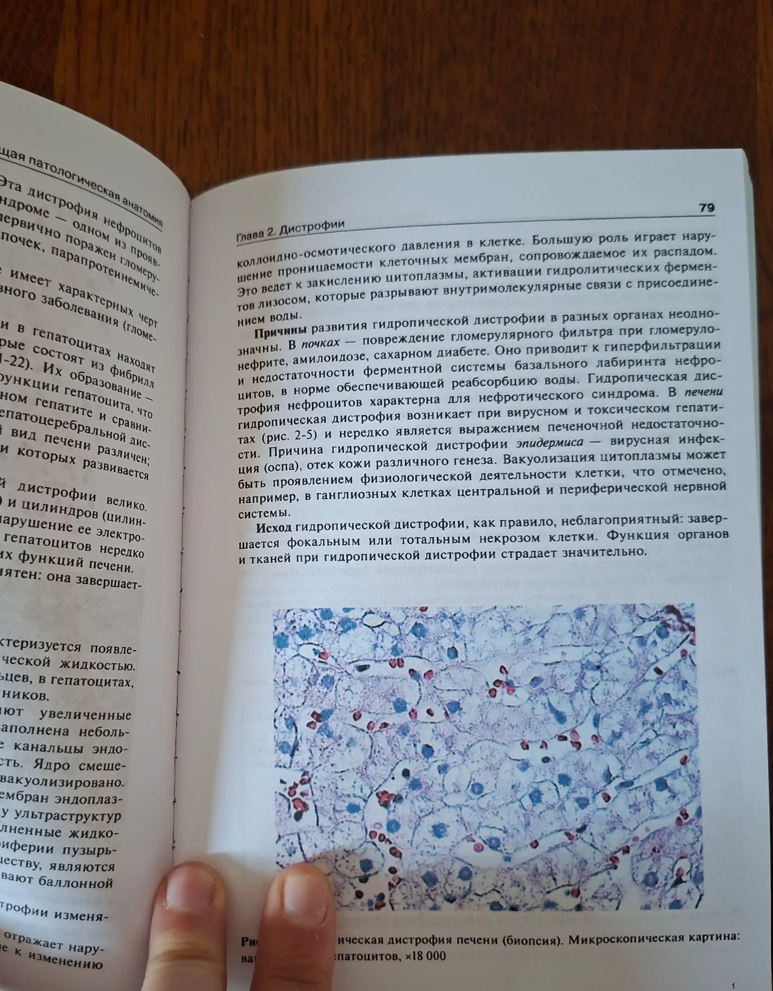 Патологическая анатомия 6-е Автор : А.Струков Год издания  2015. Медицина