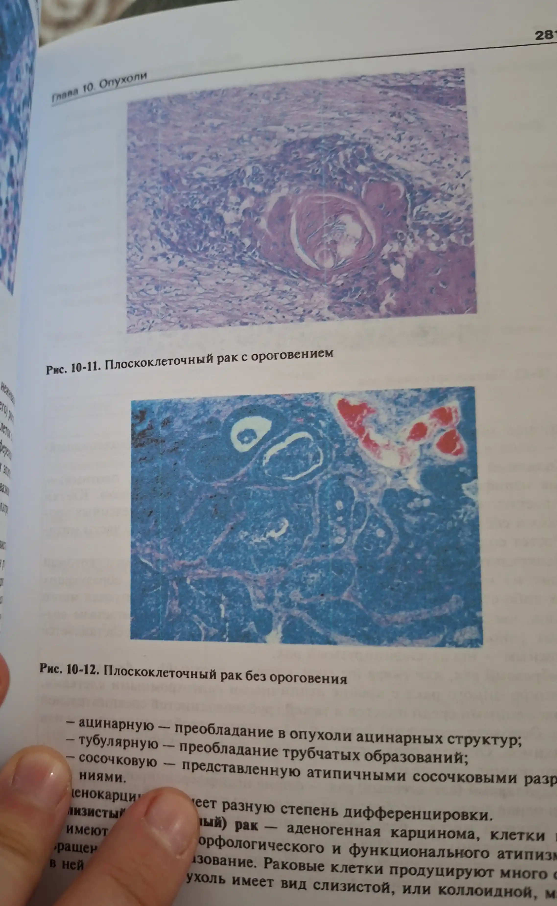 Патологическая анатомия 6-е Автор : А.Струков Год издания  2015. Медицина