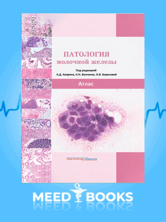 Patologiya Molochnoy Zhelezy Atlas Med kniga - 
