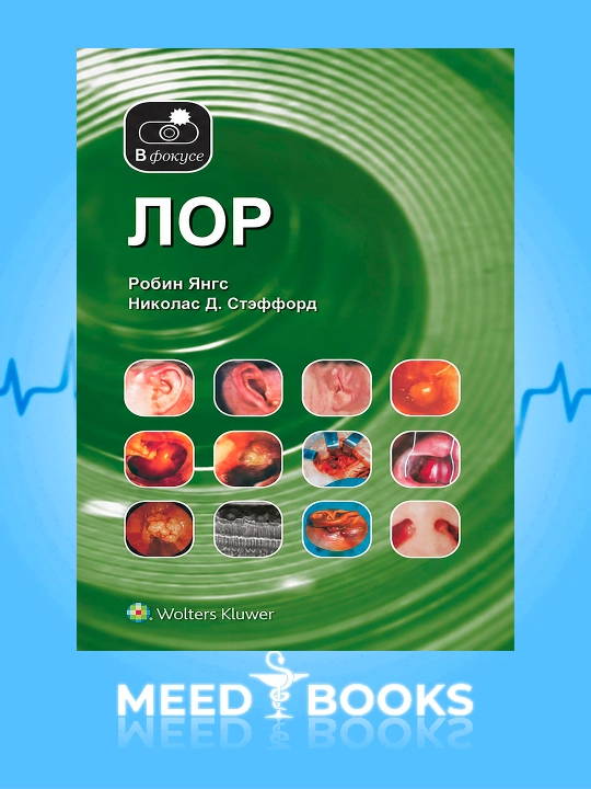 Лор - 
