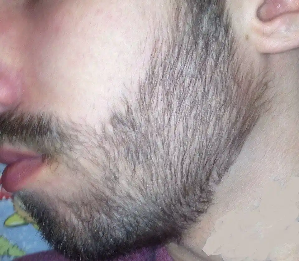 Набор Minoxidil 10% миноксидил для роста волос и бороды