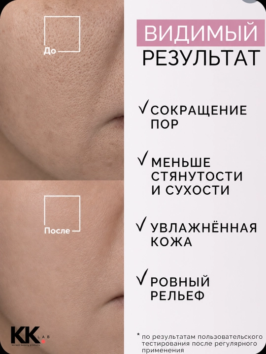 Сыворотка для сужения пор SKIN1004, с центеллой Poremizing Fresh Ampoule, 100 мл