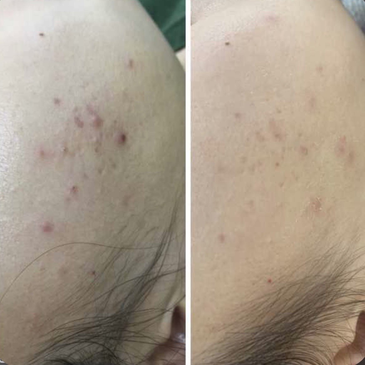 Tinchlantiruvchi va antibakterial yuz spreyi-misti Dr. Althea Rapid Hypochlorous Acid Mist