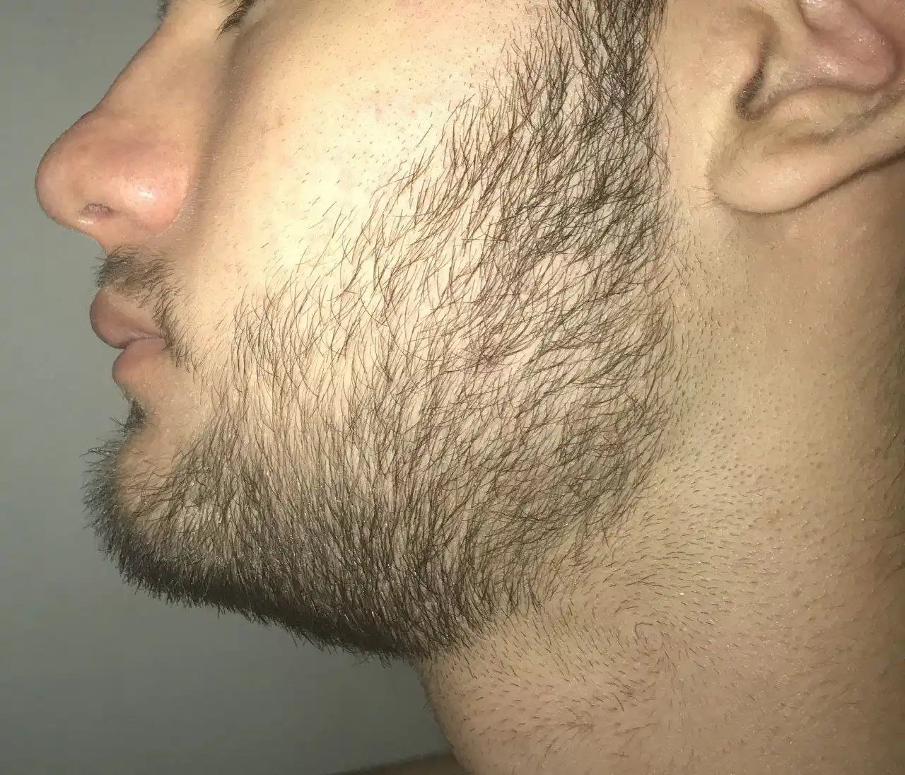 Набор Minoxidil 10% миноксидил для роста волос и бороды