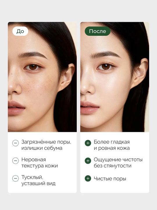 Очищающая пенка для лица Medicube Zero Foam Cleanser, для проблемной и жирной кожи