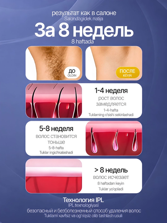 Фотоэпилятор IPL лазерный для лица и тела с эффектом охлаждения, домашний эпилятор женский