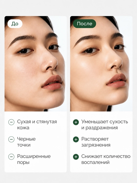 Гидрофильное масло для лица от черных точек Zero Pore