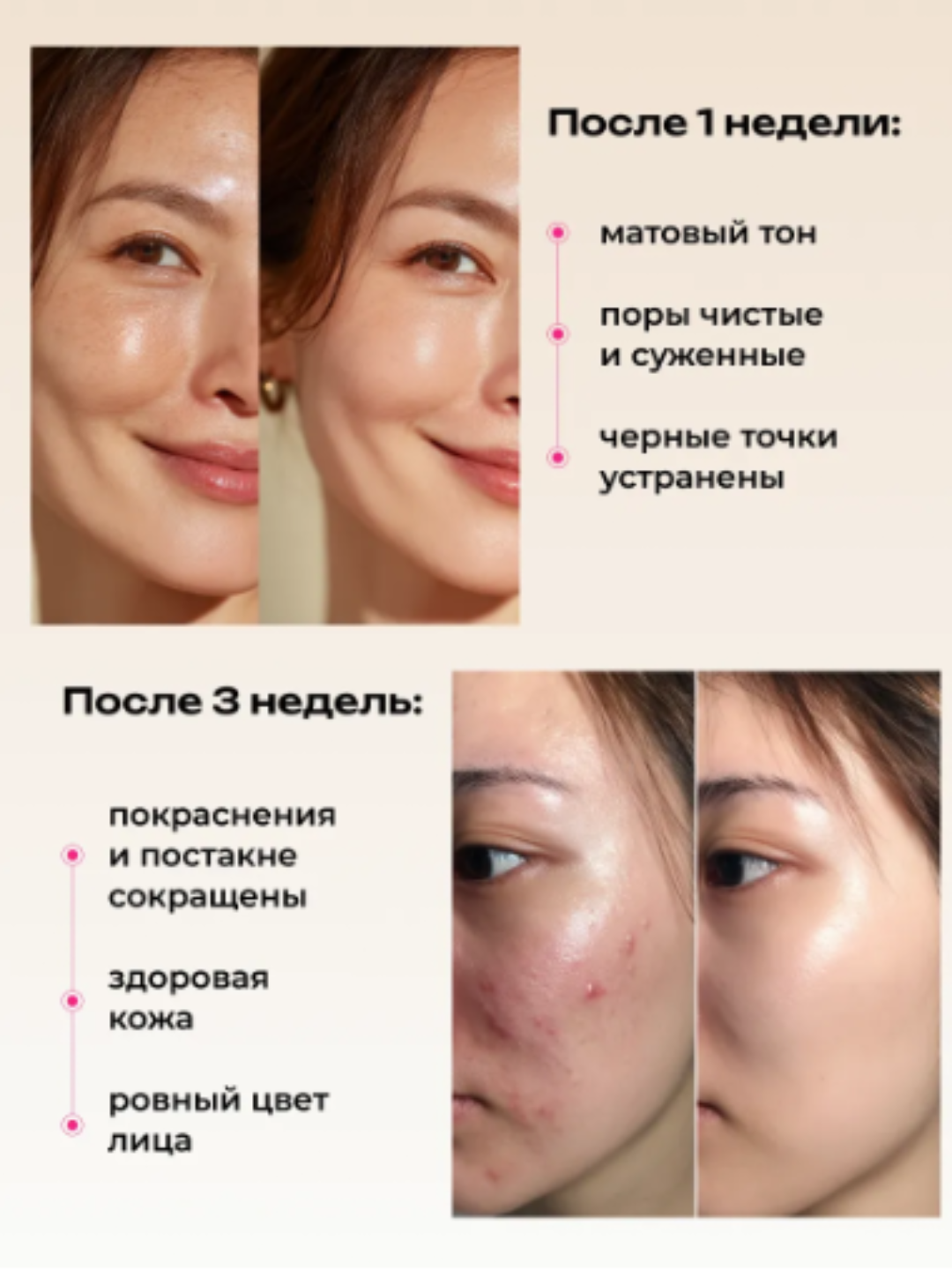 Гель для умывания лица, от прыщей, умывашка, гель умывалка, гель для лица с кислотами