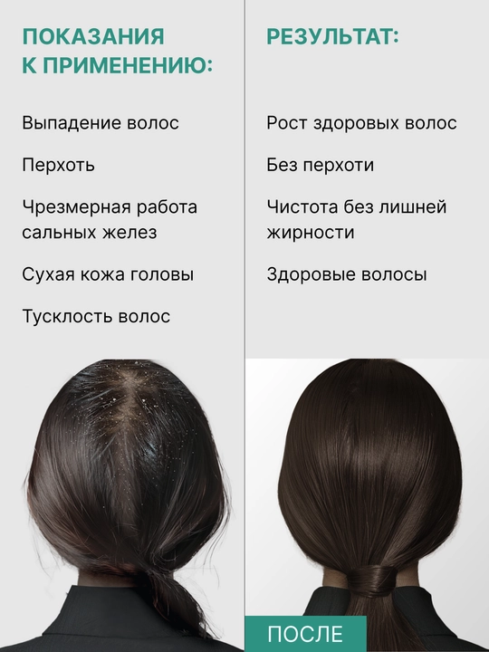 Пилинг для кожи головы профессиональный LABA AHA 11% + BHA 2%
