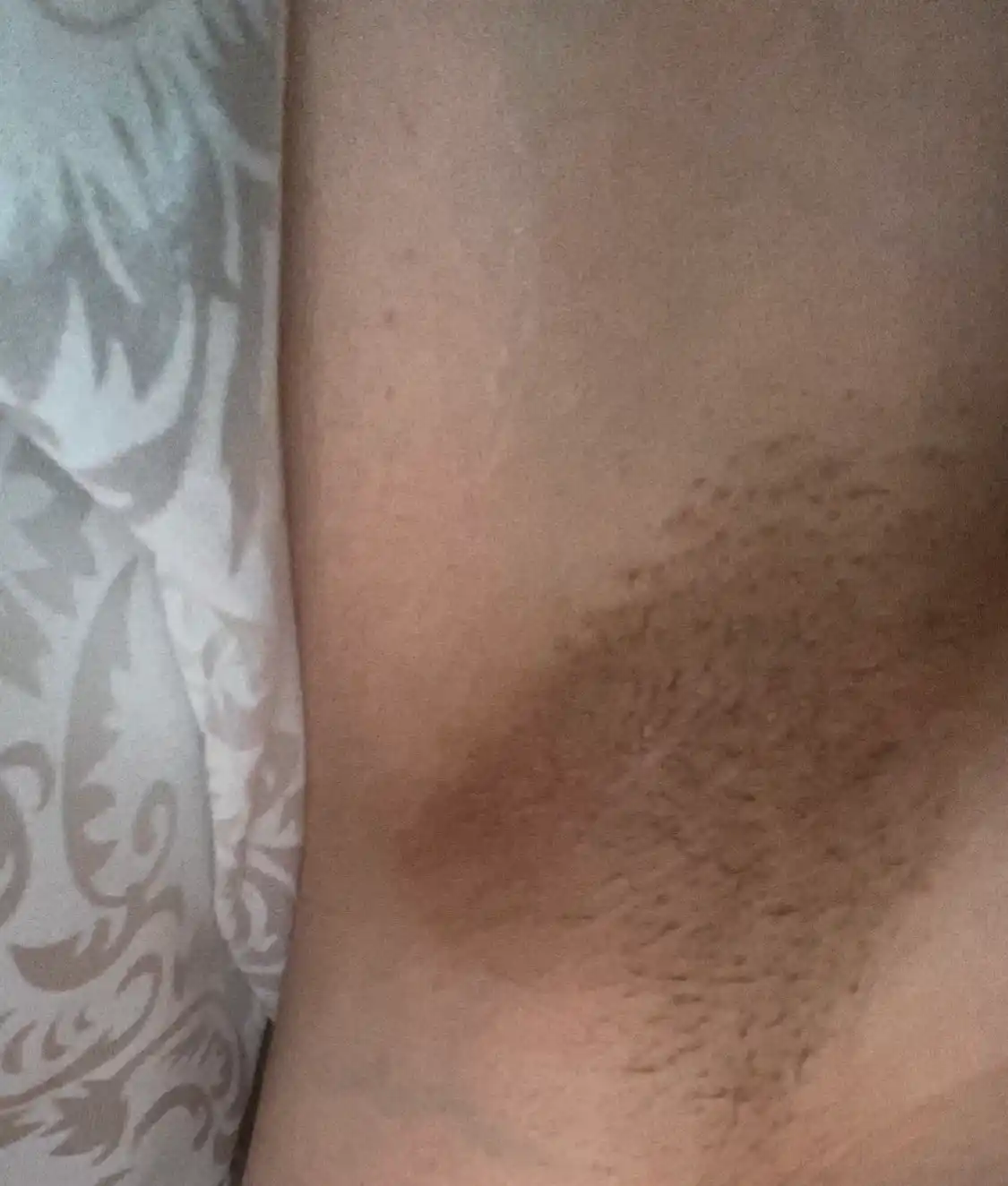Qo'ltiq osti va nozik joylar uchun oqartiruvchi krem, Tree Doctor, 80 g