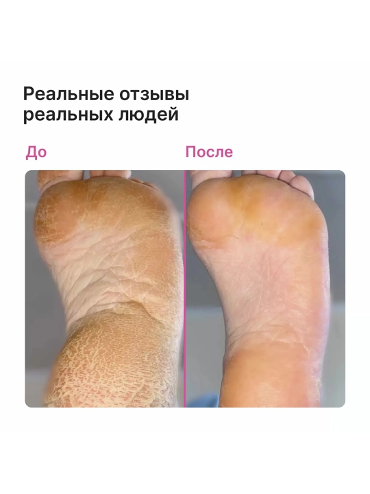 EPILPROFI Mochevina bilan pedikyur uchun gel, 400 ml