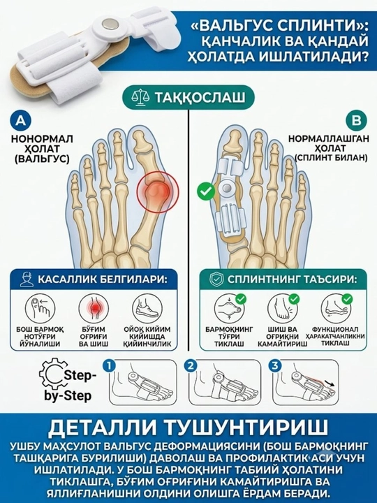 Oyoq barmoq valgus shina korrektori, suyak to'g'rilovchi va og'riq uchun fiksator