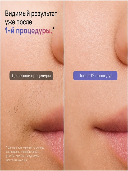 Braun Skin i·expert Smart IPL фотоэпилятор, автоадаптация к тону и датчик кожи, 10 уровней