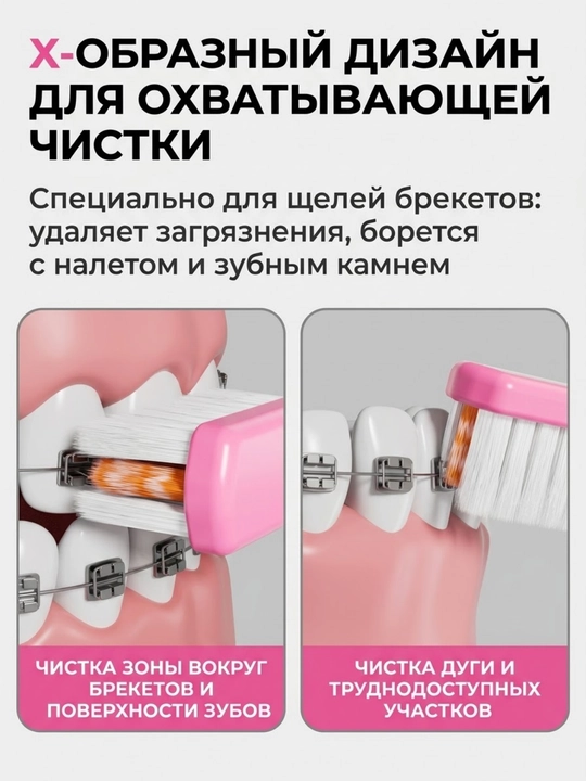 Зубная щётка для брекетов, ортодонтическая щётка, 2 шт, чистка брекетов, для брекет-систем