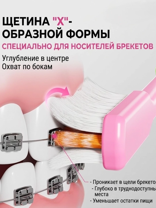 Зубная щётка для брекетов, ортодонтическая щётка, 2 шт, чистка брекетов, для брекет-систем