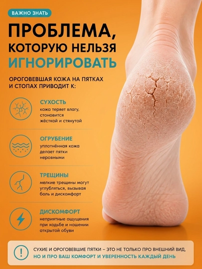 Гель для пяток Epilprofi с Алоэ Вера, средство для педикюра, от мозолей, 400 мл
