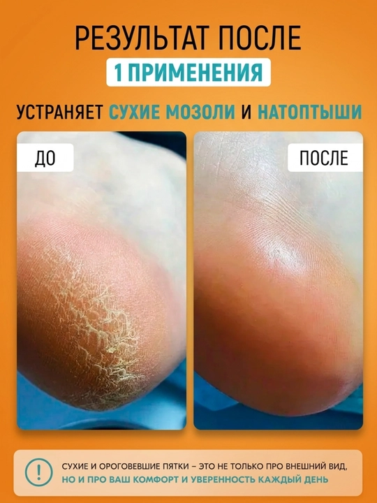 Гель для пяток Epilprofi с Алоэ Вера, средство для педикюра, от мозолей, 400 мл