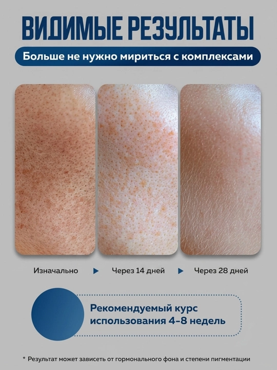 Отбеливающий крем, лосьон для интимных зон и тела, антивозрастной, сыворотка ниацинамид