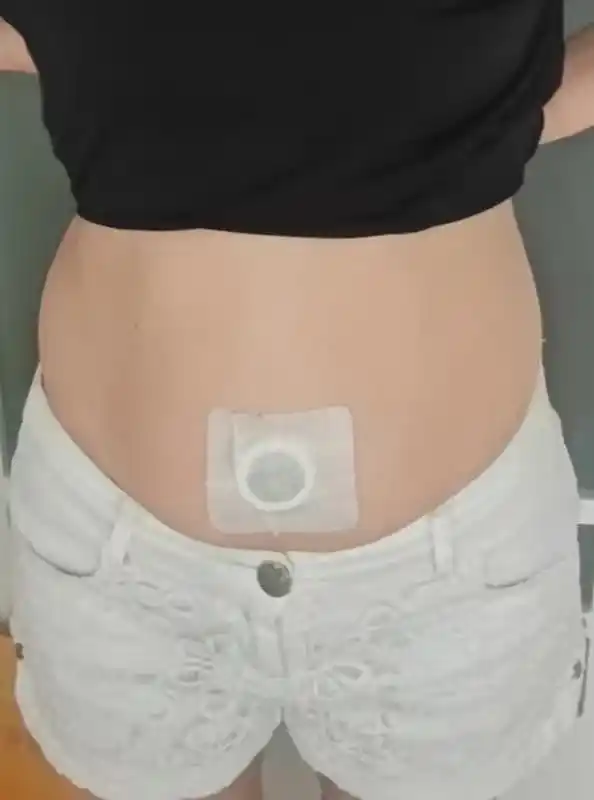 Пластырь для похудения LYDIMOON Slim Patch натуральный антицеллюлитный, на пупок, 10 шт