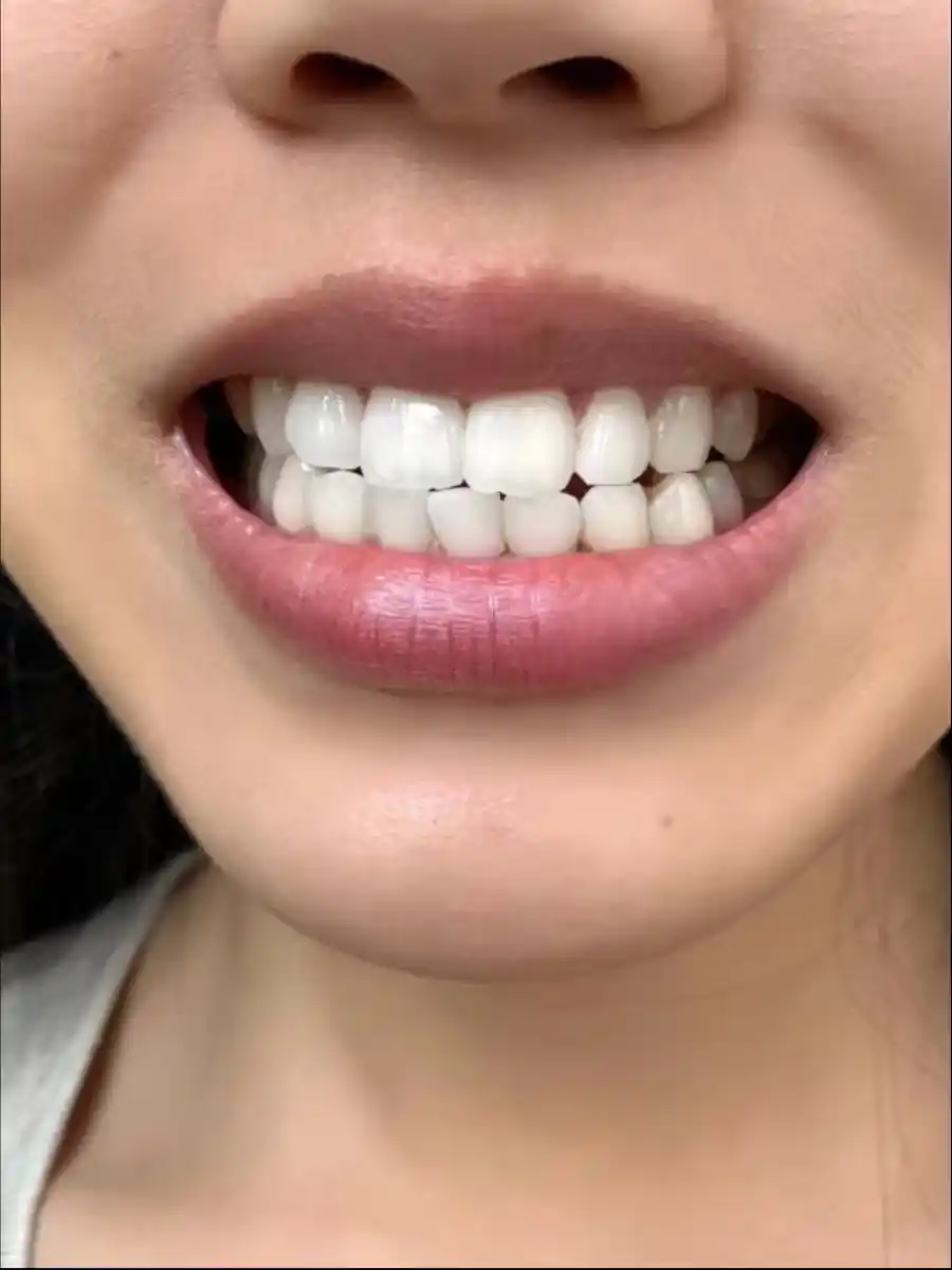 LYDIMOON probiotikli oqartiruvchi tish pastasi, yasemin, nafasni yangilaydi, 120 g