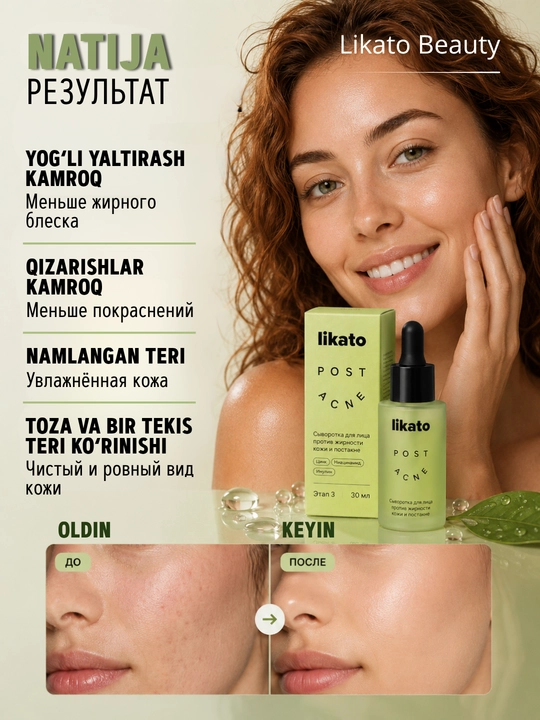 Yuz uchun serum, sivorotka yuz uchun niatsinamid va sink bilan LIKATO, 30 ml