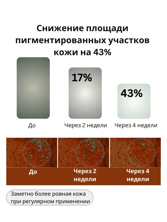 Traneksam kislotasi qo‘shilgan AXIS-Y TXA 2,5% intensiv yorituvchi krem
