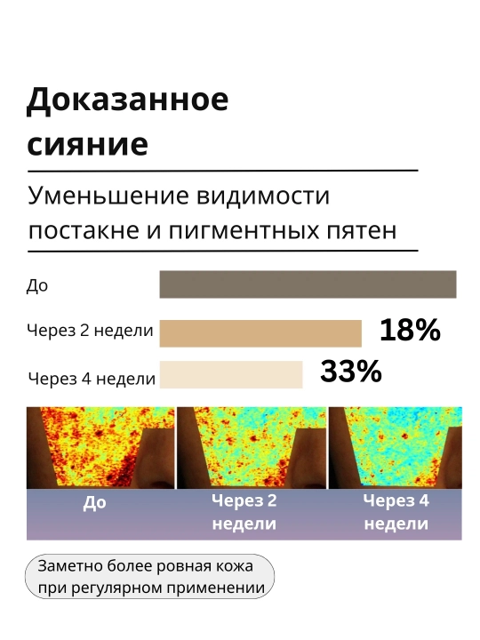 Traneksam kislotasi qo‘shilgan AXIS-Y TXA 2,5% intensiv yorituvchi krem
