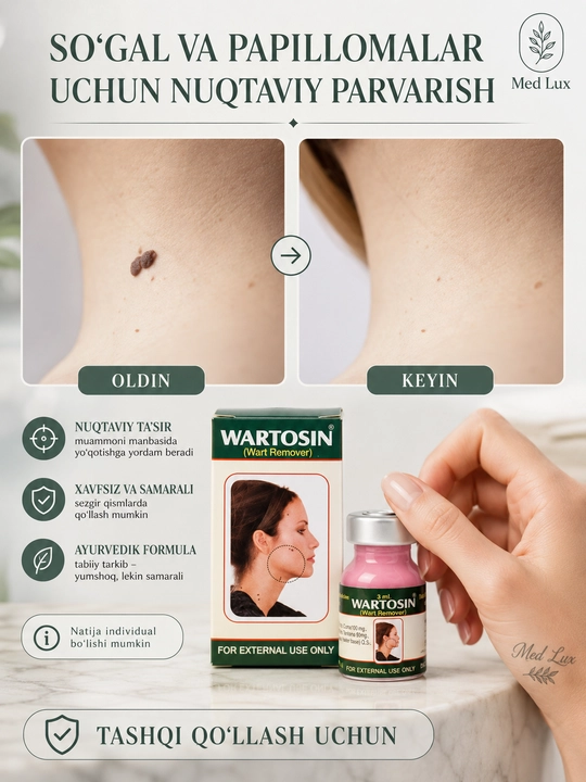 Мазь для лица и тела от папиллом и бородавок, 3 мл, Вартосин, Wartosin