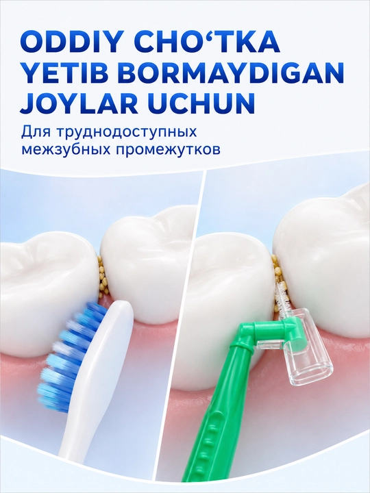 Tishlarni tozalash va breketlar uchun tishlararo yorshiklar,interdental cho‘tkalar, 5 dona