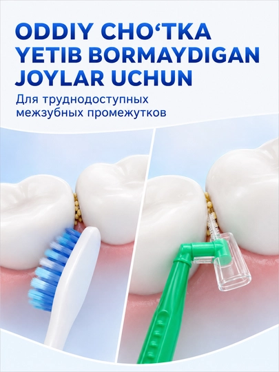 Tishlarni tozalash va breketlar uchun tishlararo yorshiklar,interdental cho‘tkalar, 5 dona