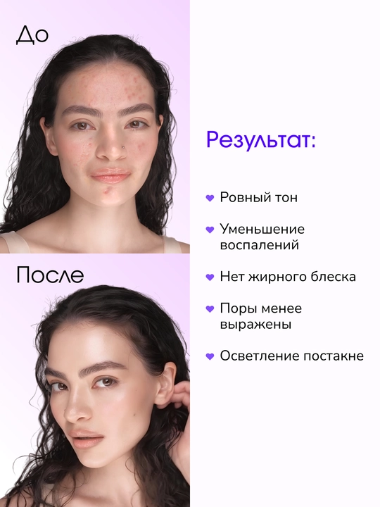 LABA Niacinamide + Vitamin C teri tonini tekislovchi yuz serumi, 30ml
