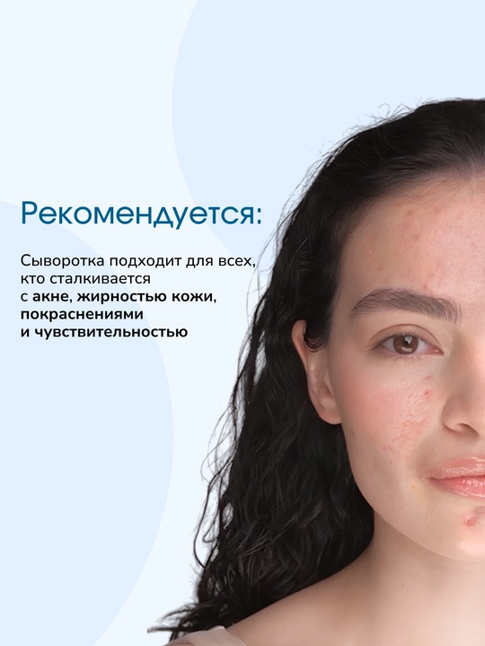 Muammoli teri uchun LABA Probiotic serum, 30 ml