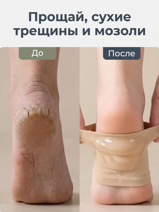 Силиконовые носки для пяток от трещин, напяточники для заживления, 1 или 2 пары