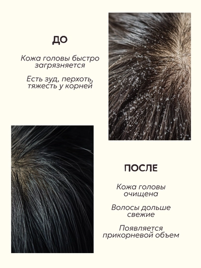 Пилинг для кожи головы от перхоти SEMILY скраб для головы, 150 мл