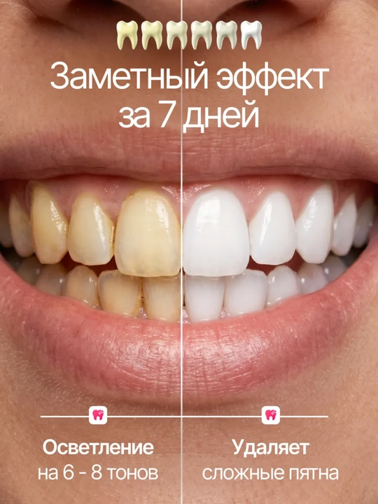 Отбеливающие полоски для зубов 5D White, отбеливатель для зубов, 7 пар