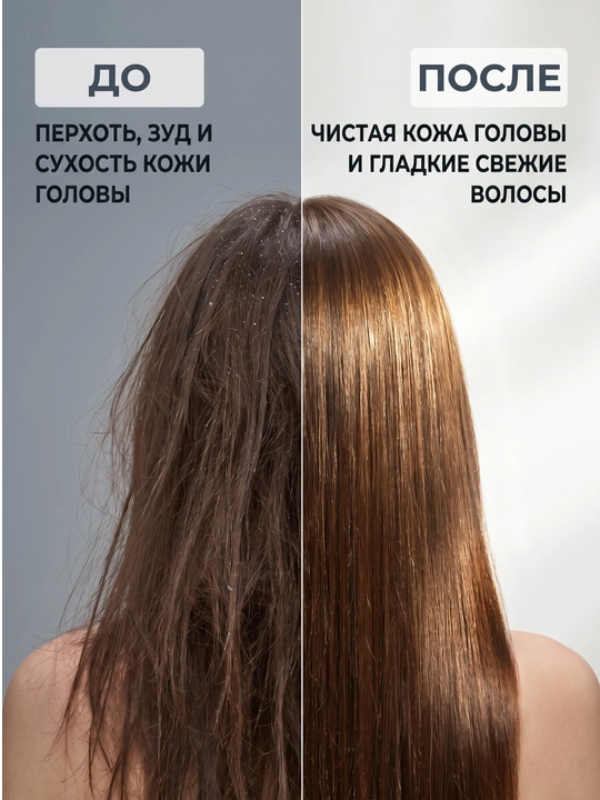 Против перхоти - шампунь и кондиционер 2 в 1 женский, Kerasys Hanaro, Корея, 680 мл