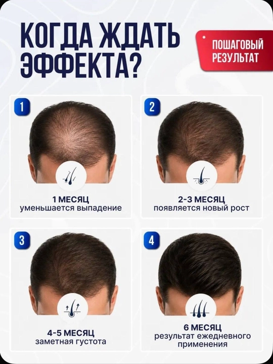 Миноксидин 5% Kirkland Signature Extra Strength средство для роста волос и бороды, 60 мл