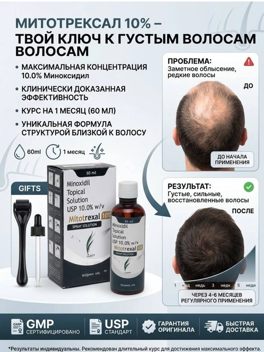Mitotrexal 10% Minoxidil — спрей для роста волос, 60 мл