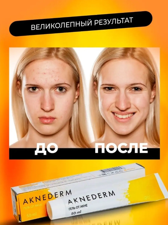 Гель от прыщей и акне, Акнедерм 50мл