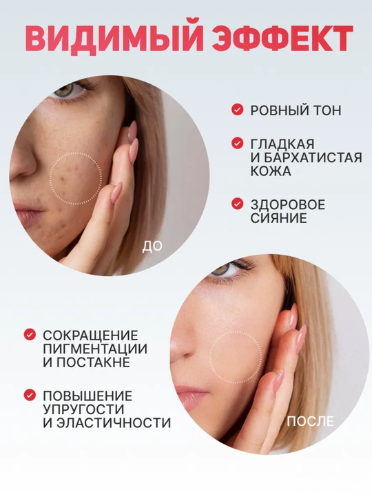 Сыворотка, серум, Anua Niacinamide 10% + TXA 4% для лица с ниацинамидом, осветляющая 30 мл